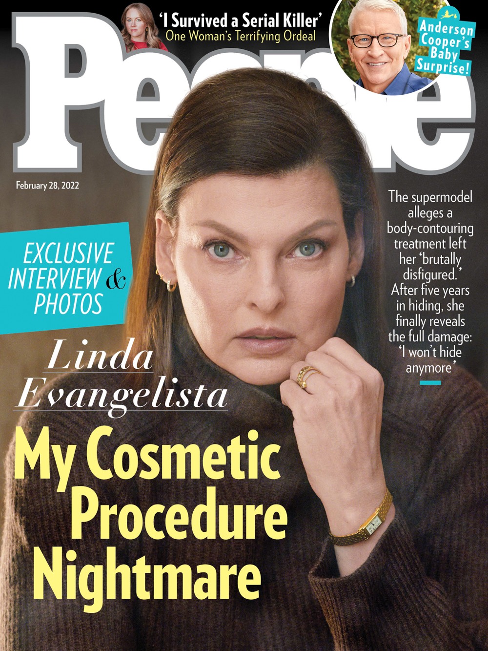 Linda Evangelista, a YouTuber who had done Coolsculpting, also had lumps & uneven patches.